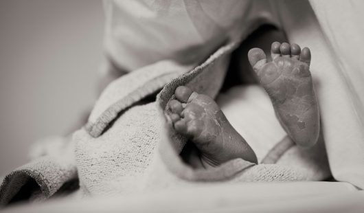 Birth Injury claims Birth Injury claims