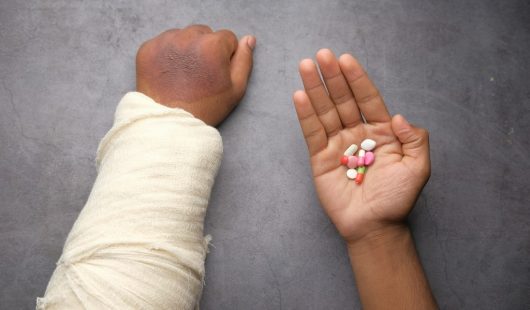 Crush Injury Claims Crush Injury Claims